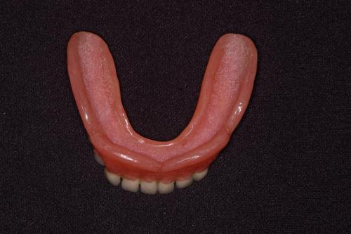 Lower Denture
