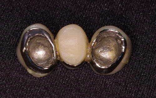 Inside of Metal Bridge