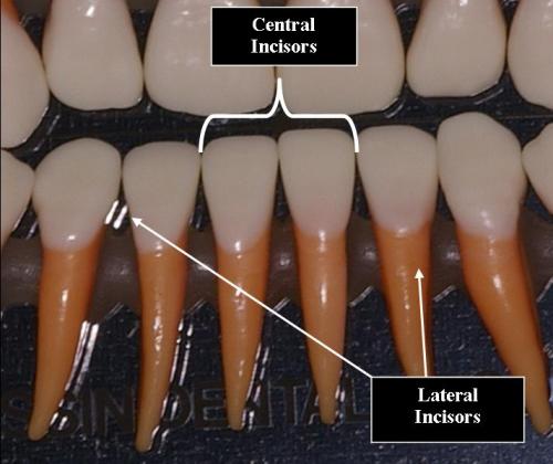 Mandible Lateral and Central Incisors