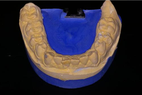Mandibular Model With Teeth